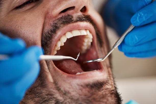 Best Weekend Emergency Dentist in Martins Additions, MD