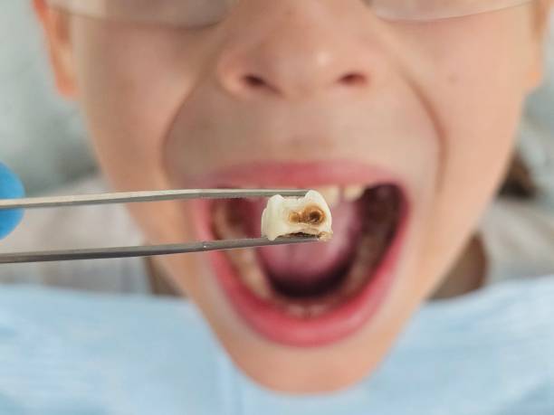 Best Weekend Emergency Dentist in Martins Additions, MD